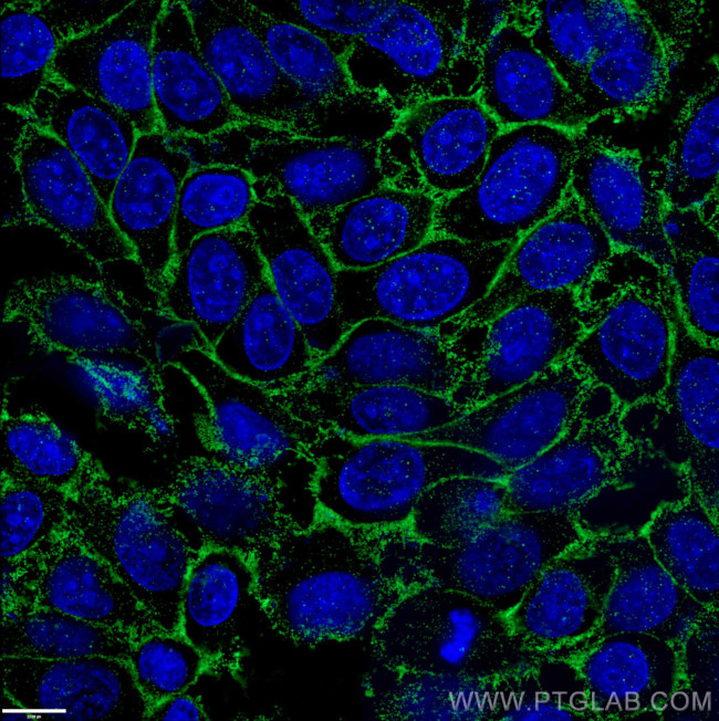 CD44 Antibody in Immunocytochemistry (ICC/IF)
