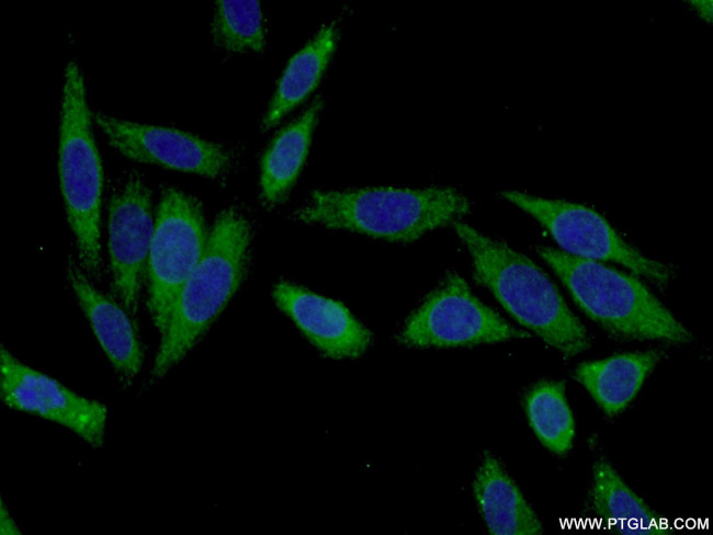 KHK Antibody in Immunocytochemistry (ICC/IF)