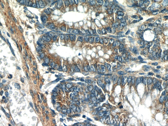 UBE2H Antibody in Immunohistochemistry (Paraffin) (IHC (P))