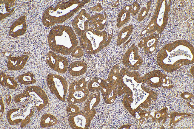 ERCC6L Antibody in Immunohistochemistry (Paraffin) (IHC (P))