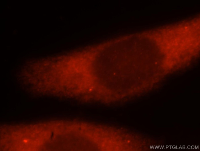 ATXN10 Antibody in Immunocytochemistry (ICC/IF)
