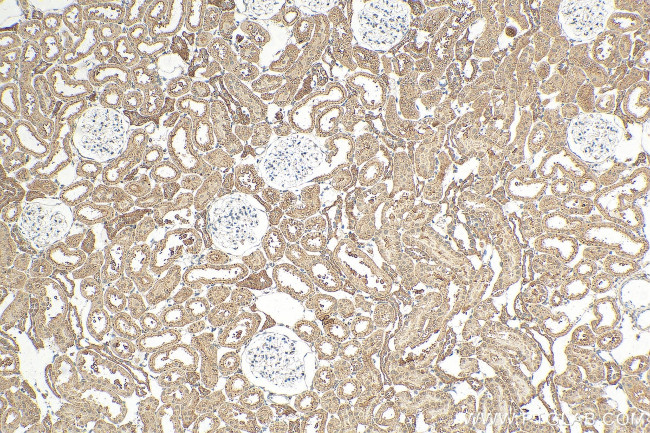 CCNJ Antibody in Immunohistochemistry (Paraffin) (IHC (P))