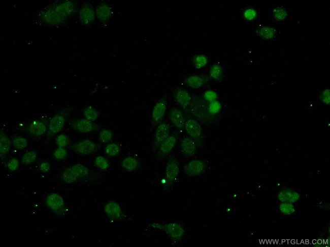 SSRP1 Antibody in Immunocytochemistry (ICC/IF)