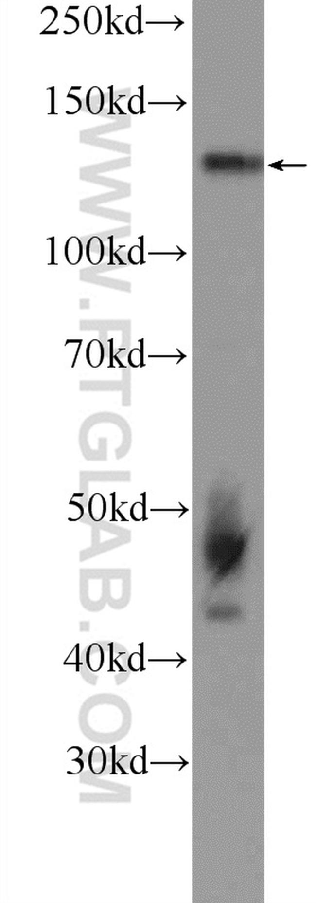 NOL6 Antibody in Western Blot (WB)