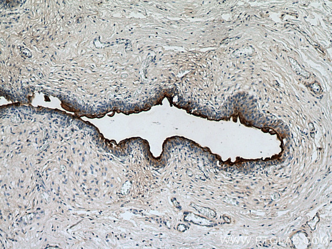 UPK3B Antibody in Immunohistochemistry (Paraffin) (IHC (P))