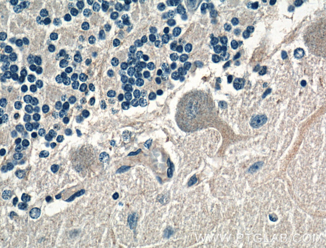 AMPD2 Antibody in Immunohistochemistry (Paraffin) (IHC (P))
