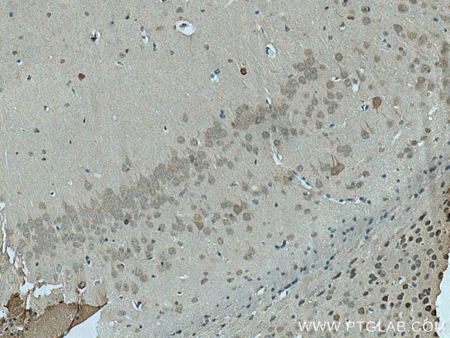 RIMBP2 Antibody in Immunohistochemistry (Paraffin) (IHC (P))