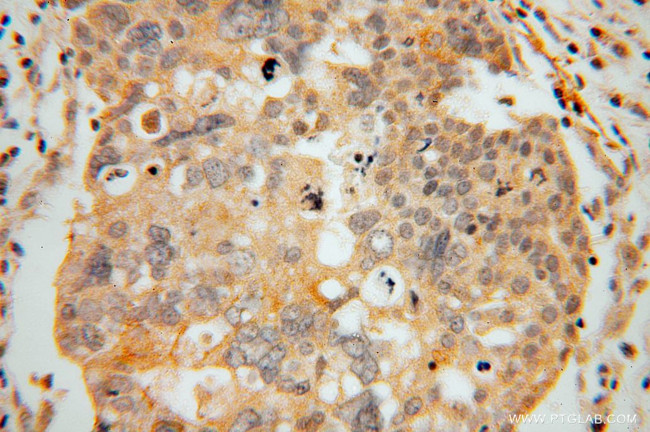 GLYATL1 Antibody in Immunohistochemistry (Paraffin) (IHC (P))