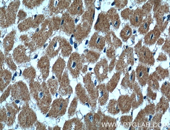 CLPB Antibody in Immunohistochemistry (Paraffin) (IHC (P))