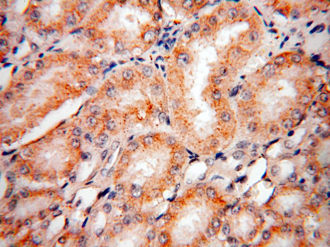 PEX11G Antibody in Immunohistochemistry (Paraffin) (IHC (P))