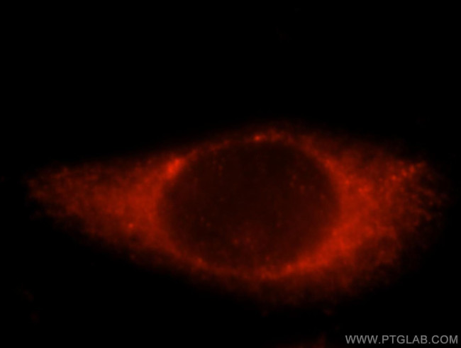 ALDH3B2 Antibody in Immunocytochemistry (ICC/IF)