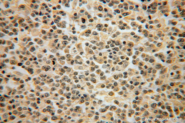 DOK3 Antibody in Immunohistochemistry (Paraffin) (IHC (P))