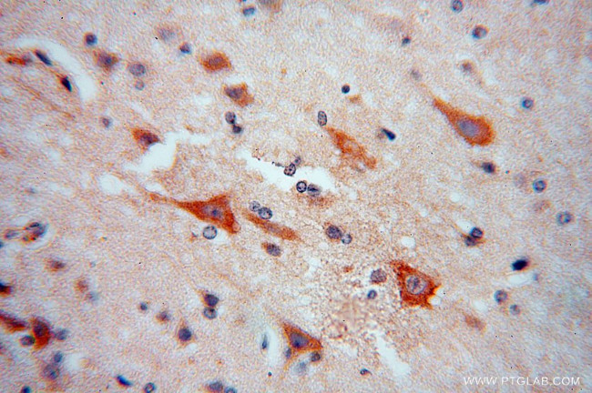 RPL18A Antibody in Immunohistochemistry (Paraffin) (IHC (P))