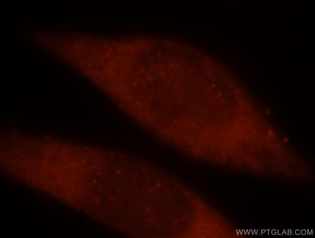 TRBP Antibody in Immunocytochemistry (ICC/IF)