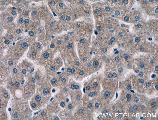 NMRAL1 Antibody in Immunohistochemistry (Paraffin) (IHC (P))