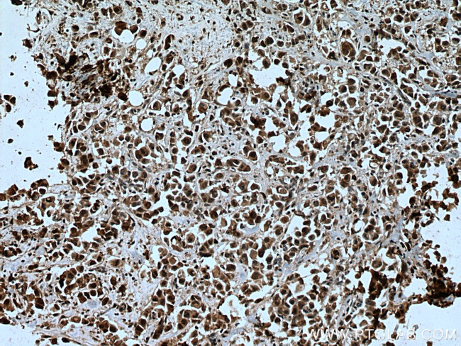 ENY2 Antibody in Immunohistochemistry (Paraffin) (IHC (P))