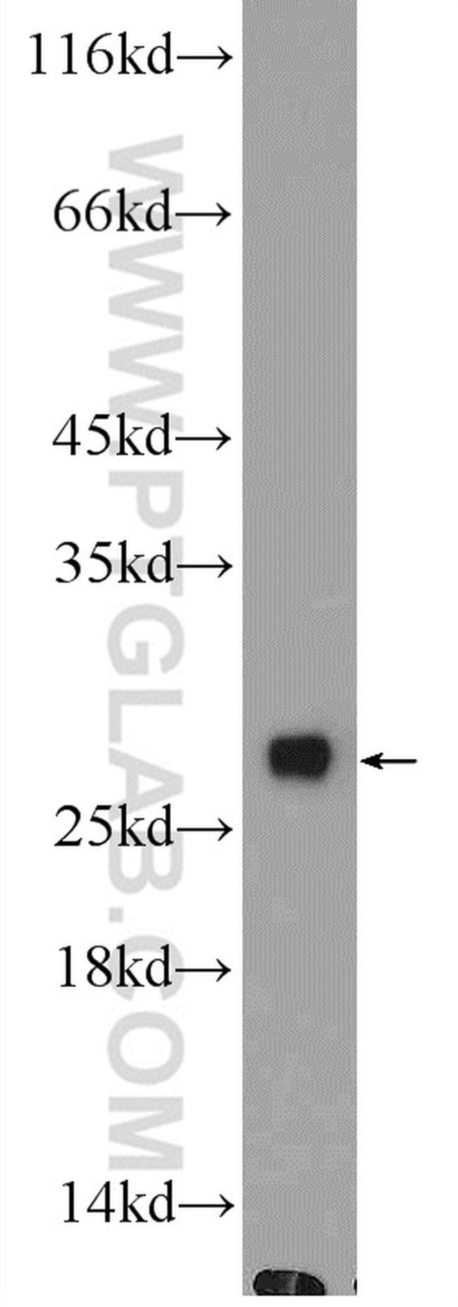 Grancalcin Antibody in Western Blot (WB)