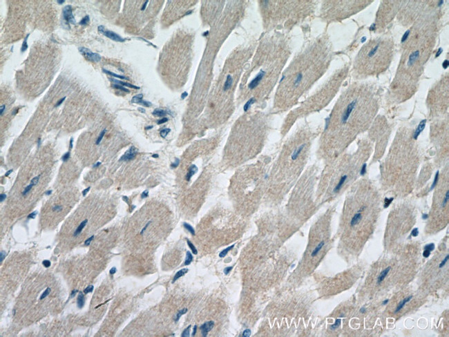 ANAPC10 Antibody in Immunohistochemistry (Paraffin) (IHC (P))
