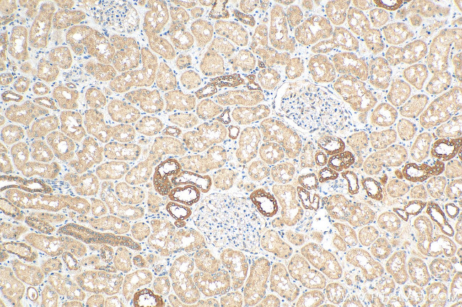 SMPX Antibody in Immunohistochemistry (Paraffin) (IHC (P))