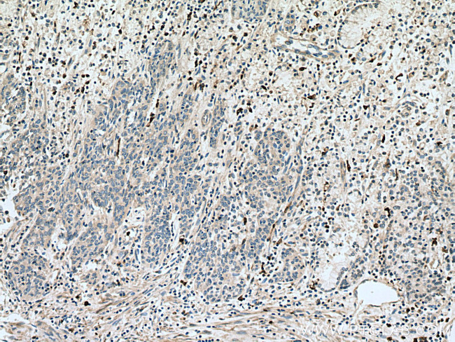 S100A8 Antibody in Immunohistochemistry (Paraffin) (IHC (P))
