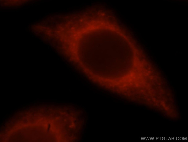 BAP29 Antibody in Immunocytochemistry (ICC/IF)
