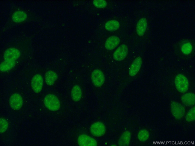 CIP29 Antibody in Immunocytochemistry (ICC/IF)