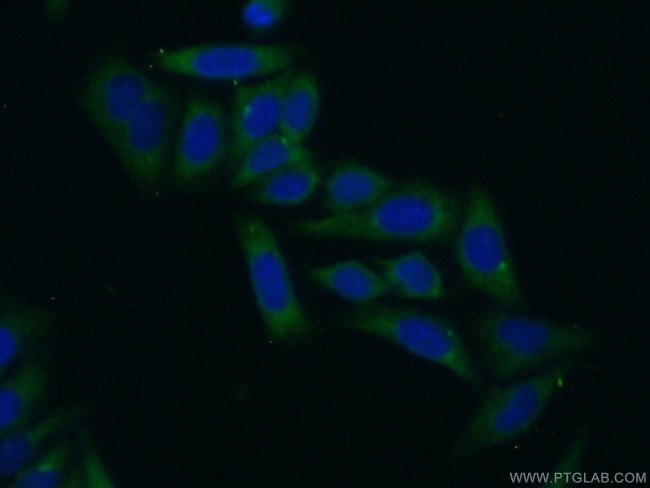 RPL29 Antibody in Immunocytochemistry (ICC/IF)
