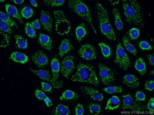 LRCH3 Antibody in Immunocytochemistry (ICC/IF)