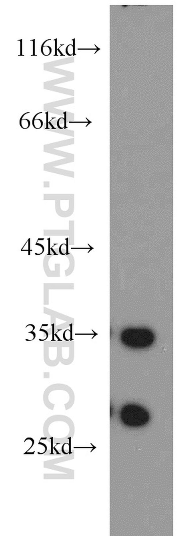 Calpain S2 Antibody in Western Blot (WB)
