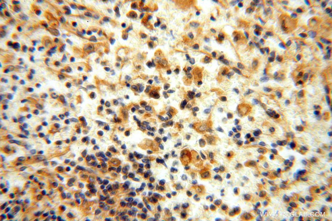 FXYD6 Antibody in Immunohistochemistry (Paraffin) (IHC (P))