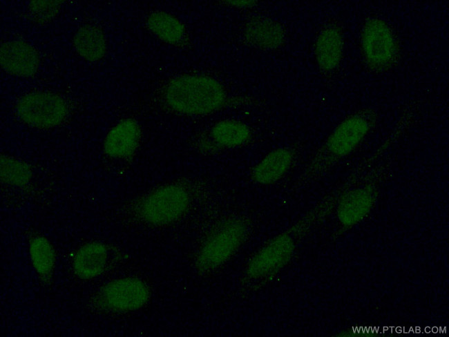 Alpha B Crystallin Antibody in Immunocytochemistry (ICC/IF)