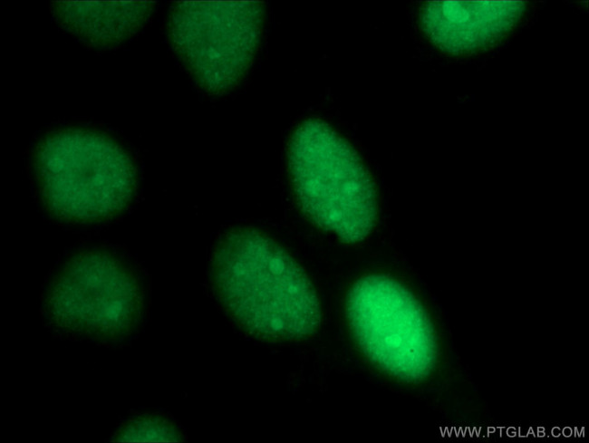ANP32A Antibody in Immunocytochemistry (ICC/IF)