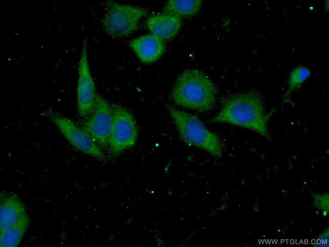 RFK Antibody in Immunocytochemistry (ICC/IF)