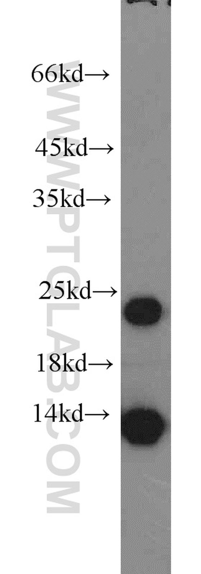 MYL1 Antibody in Western Blot (WB)