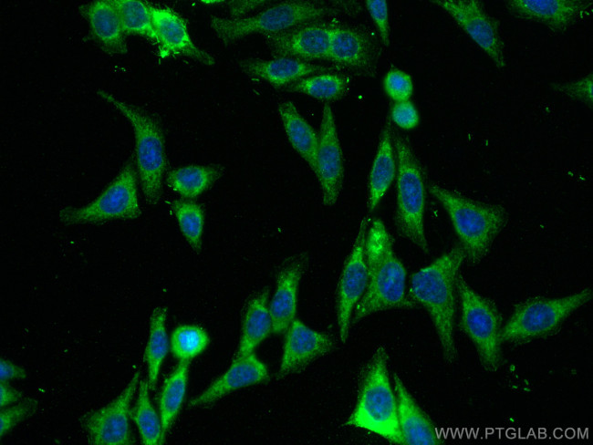 HMMR Antibody in Immunocytochemistry (ICC/IF)