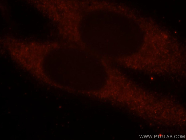 domain-I-of-FIZ-1 Antibody in Immunocytochemistry (ICC/IF)