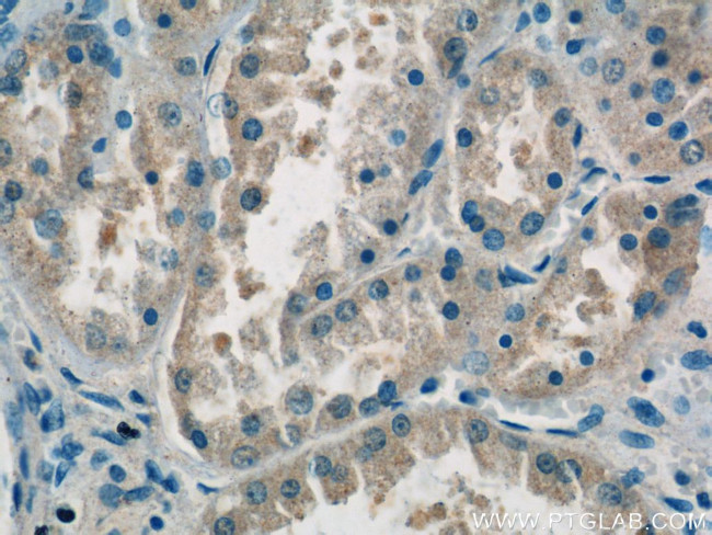 domain-II-of-FIZ1 Antibody in Immunohistochemistry (Paraffin) (IHC (P))