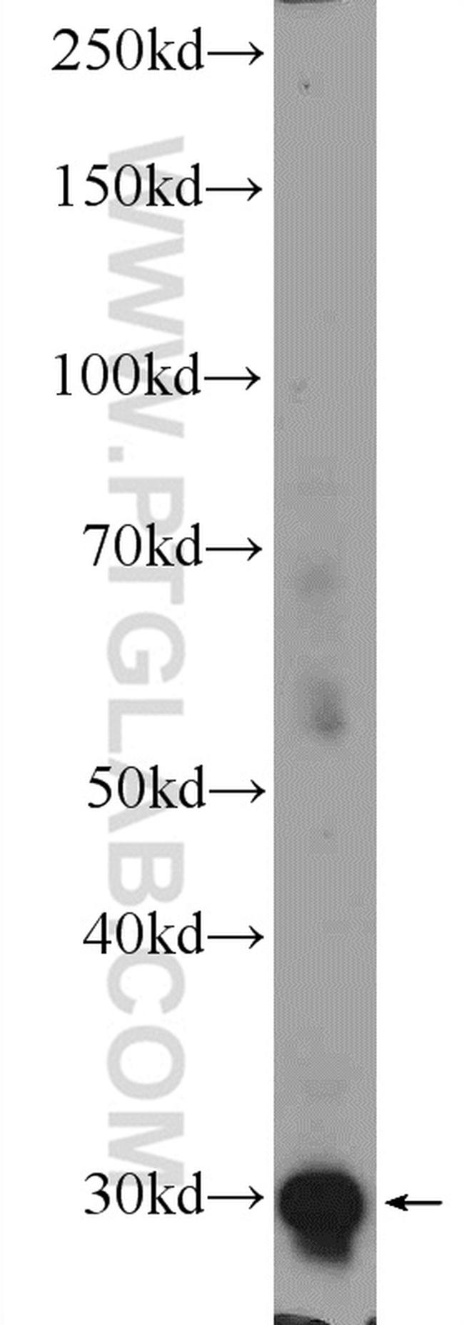 FOSL2 Antibody in Western Blot (WB)