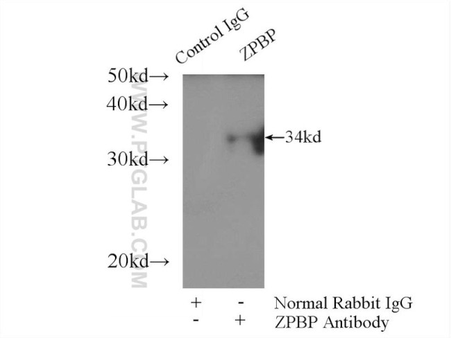 ZPBP Antibody in Immunoprecipitation (IP)