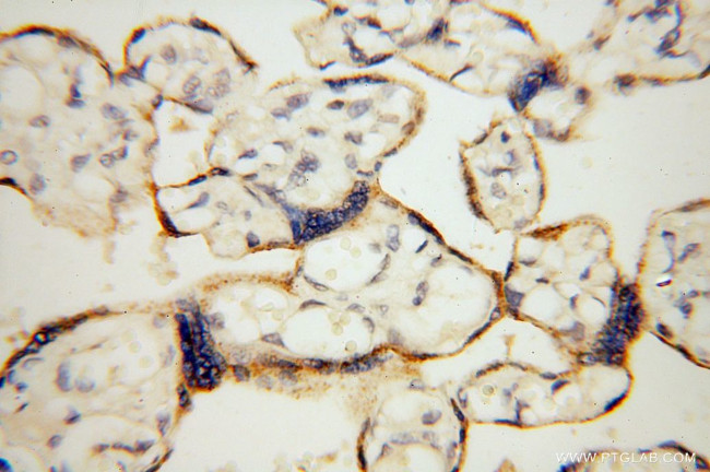 Carboxypeptidase A1 Antibody in Immunohistochemistry (Paraffin) (IHC (P))