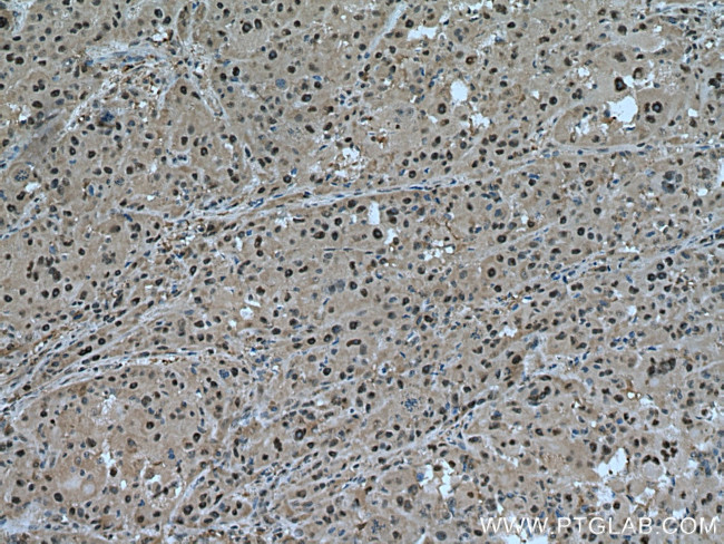 PSMC6 Antibody in Immunohistochemistry (Paraffin) (IHC (P))
