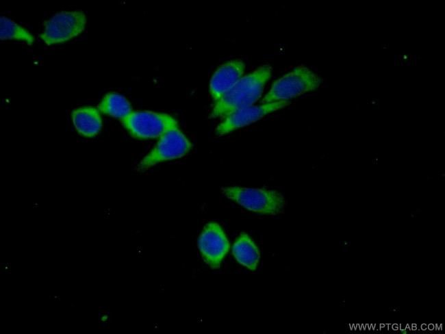 ACPP Antibody in Immunocytochemistry (ICC/IF)