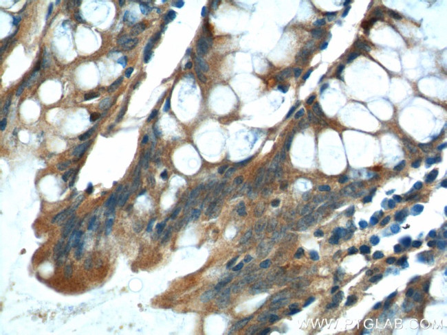 NDUFS4 Antibody in Immunohistochemistry (Paraffin) (IHC (P))