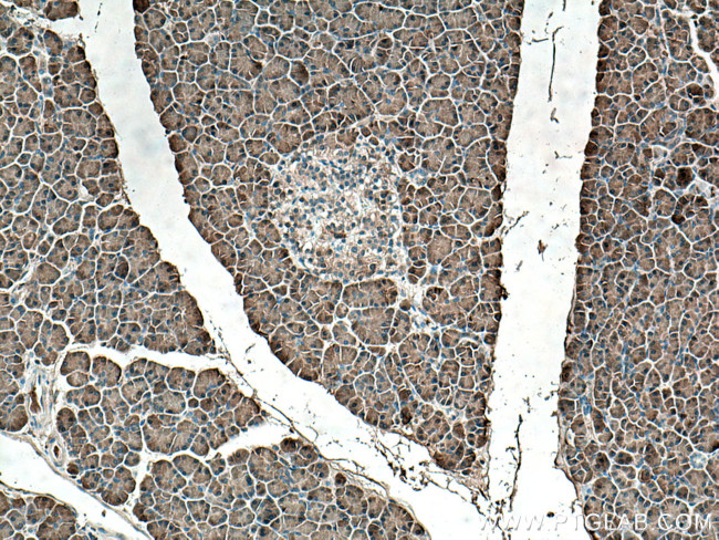 REG Antibody in Immunohistochemistry (Paraffin) (IHC (P))