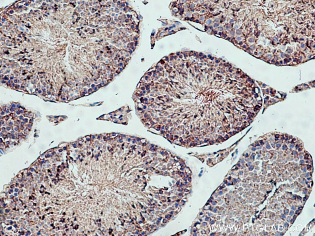 PPP6C Antibody in Immunohistochemistry (Paraffin) (IHC (P))
