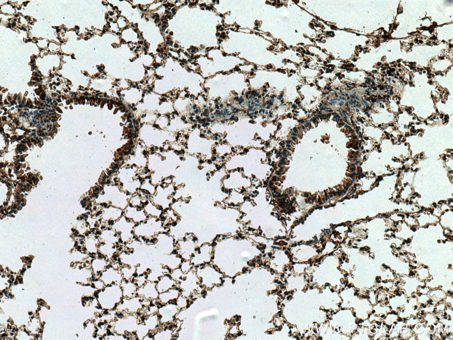 CYTL1 Antibody in Immunohistochemistry (Paraffin) (IHC (P))