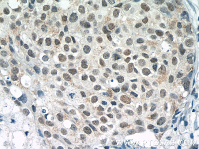 Histone H2B Antibody in Immunohistochemistry (Paraffin) (IHC (P))