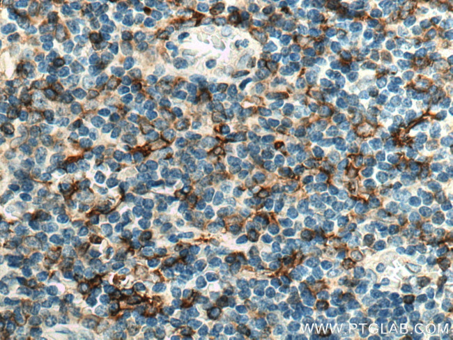 HLA-DRB1 Antibody in Immunohistochemistry (Paraffin) (IHC (P))