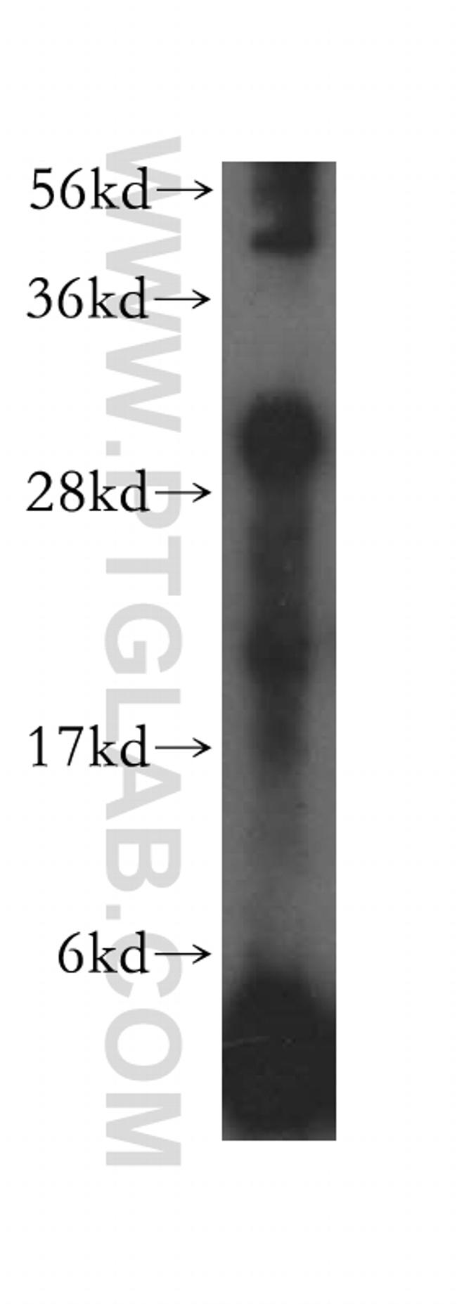 HLA-DRB1 Antibody in Western Blot (WB)