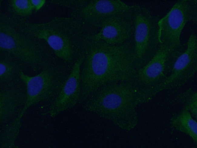 CAP2 Antibody in Immunocytochemistry (ICC/IF)